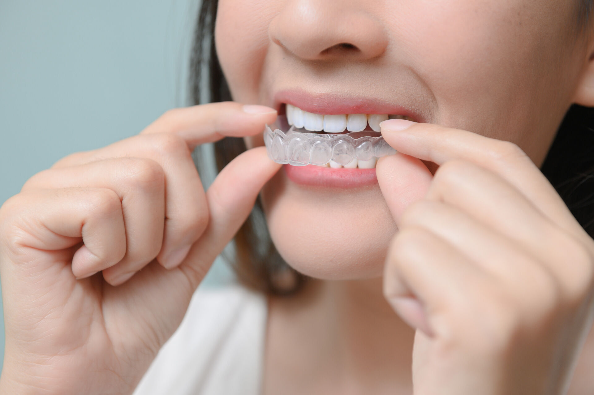 Orthodontic