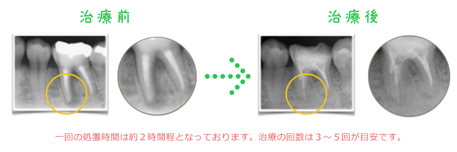 治療前治療後